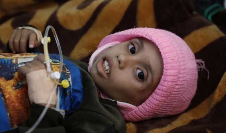 فاينانشال تايمز ... إدارة ترامب تدفع اليمن إلى المجاعة 