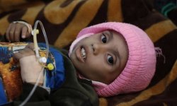 فاينانشال تايمز ... إدارة ترامب تدفع اليمن إلى المجاعة 