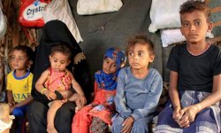 الجوع والمرض يقتلان طفلًا يمنيًا كل 10 دقائق 