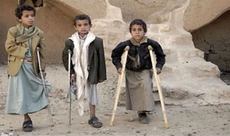 خلال شهر.. استشهاد وإصابة 49 يمنيًا بقنابل وألغام العدوان