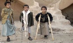 خلال شهر.. استشهاد وإصابة 49 يمنيًا بقنابل وألغام العدوان