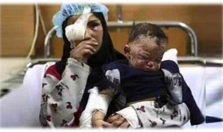 المرأة اليمنية: ما أوهنها قصف ولا أخضعها حصار