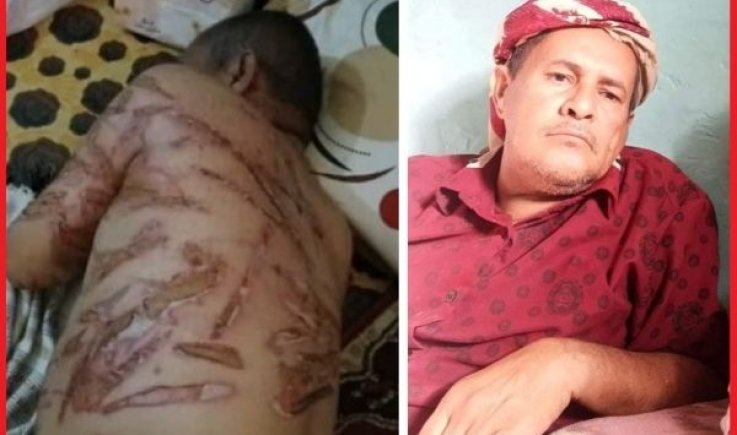 مقتل موطن شمالي في سجن للانتقالي في ابين :تفاصيل: