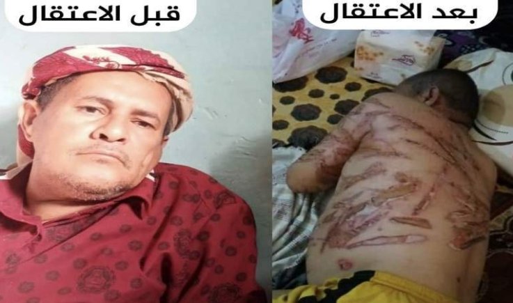 تفاصيل جديدة حول جريمة التعذيب الوحشي بحق المواطن محمد مهدي..