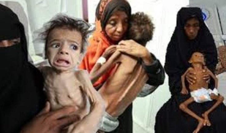 شبكة دولية تحذر من انهيار غذائي حاد في اليمن جراء العدوان والحصار