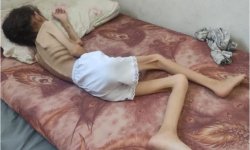في نداء عاجل لها .. الأمم المتحدة : أكثر من 100 طفل قضوا نحبهم جوعا في غزة