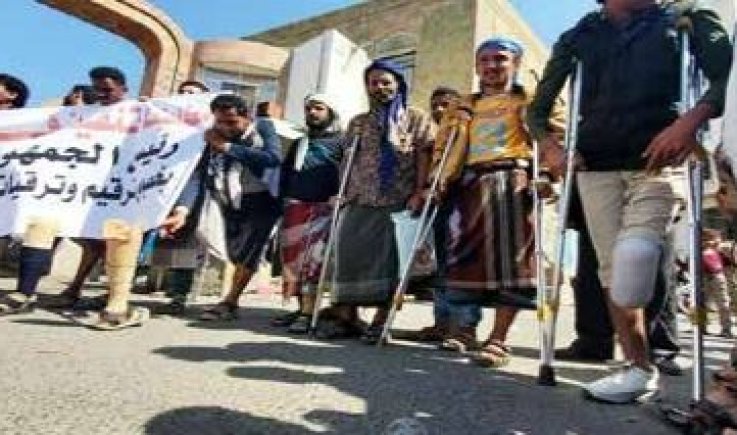 جرحى مرتزقة العدوان في تعز يحرقون أطرافهم الصناعية احتجاجاً على قطع رواتبهم