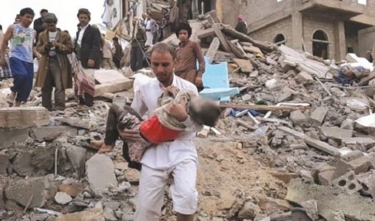منظمة إنسان.. الخسائر الاقتصادية اليمنية جراء العدوان تُقدَّر بتريليون و131 مليار دولار